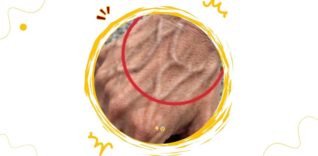 Visible Veins What Your Body Is Telling You